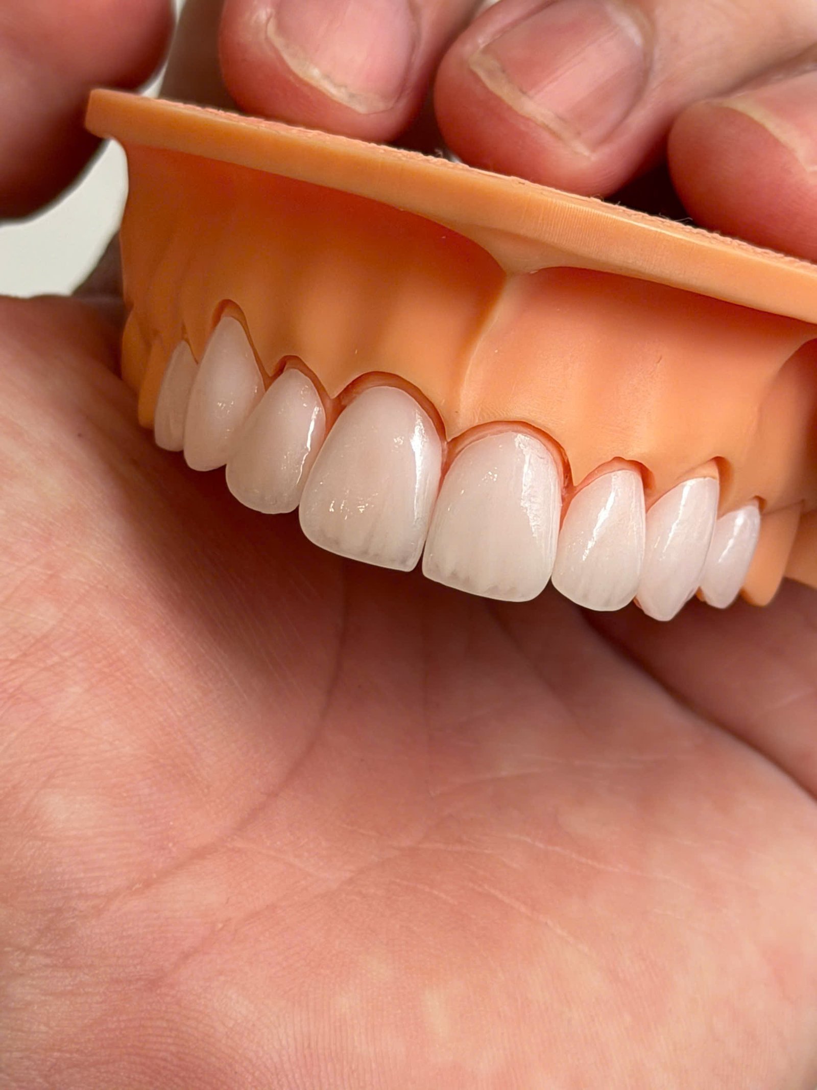 Hình ảnh sản phẩm Pro Dental Lab
