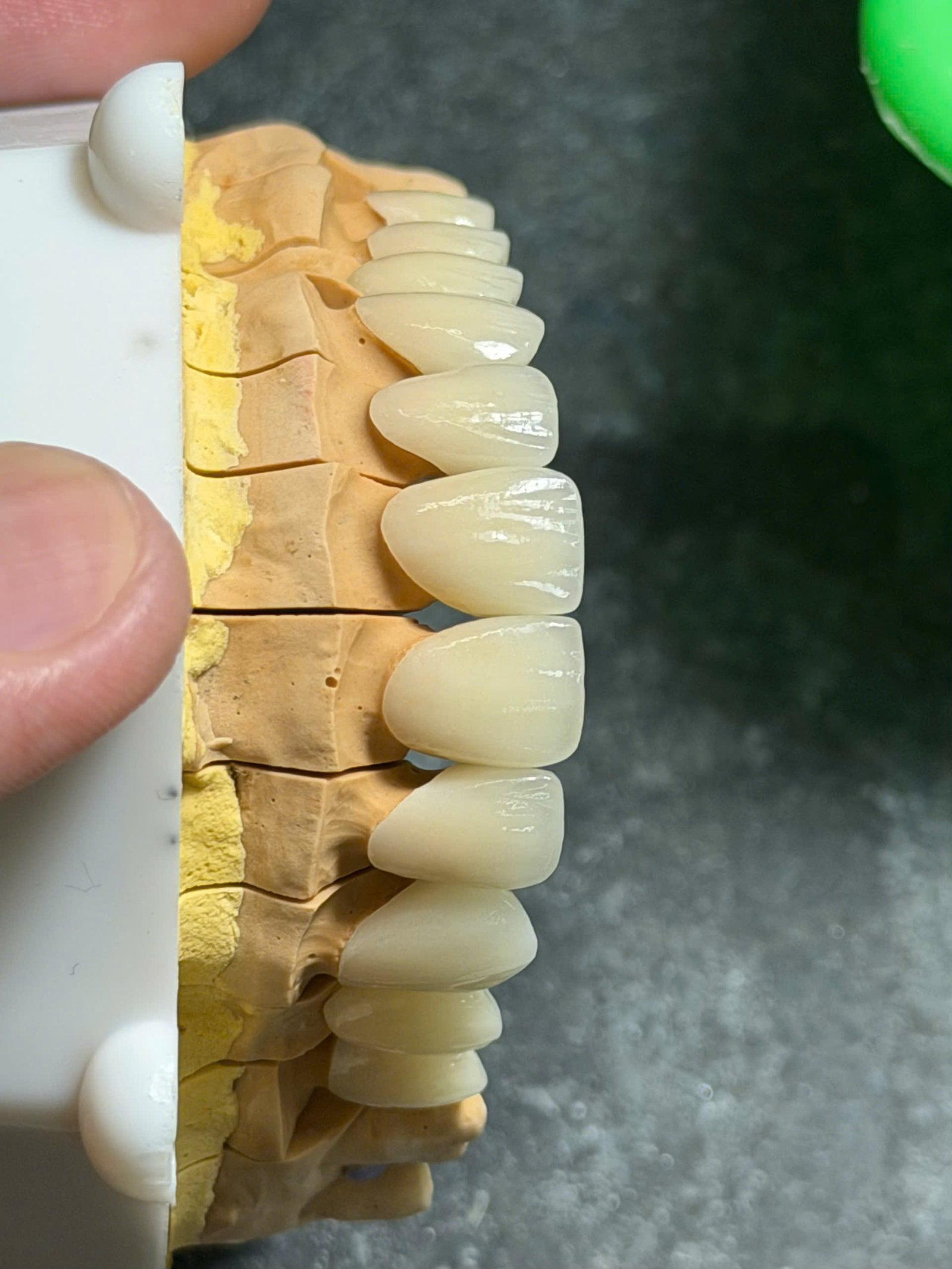 Hình ảnh sản phẩm Pro Dental Lab