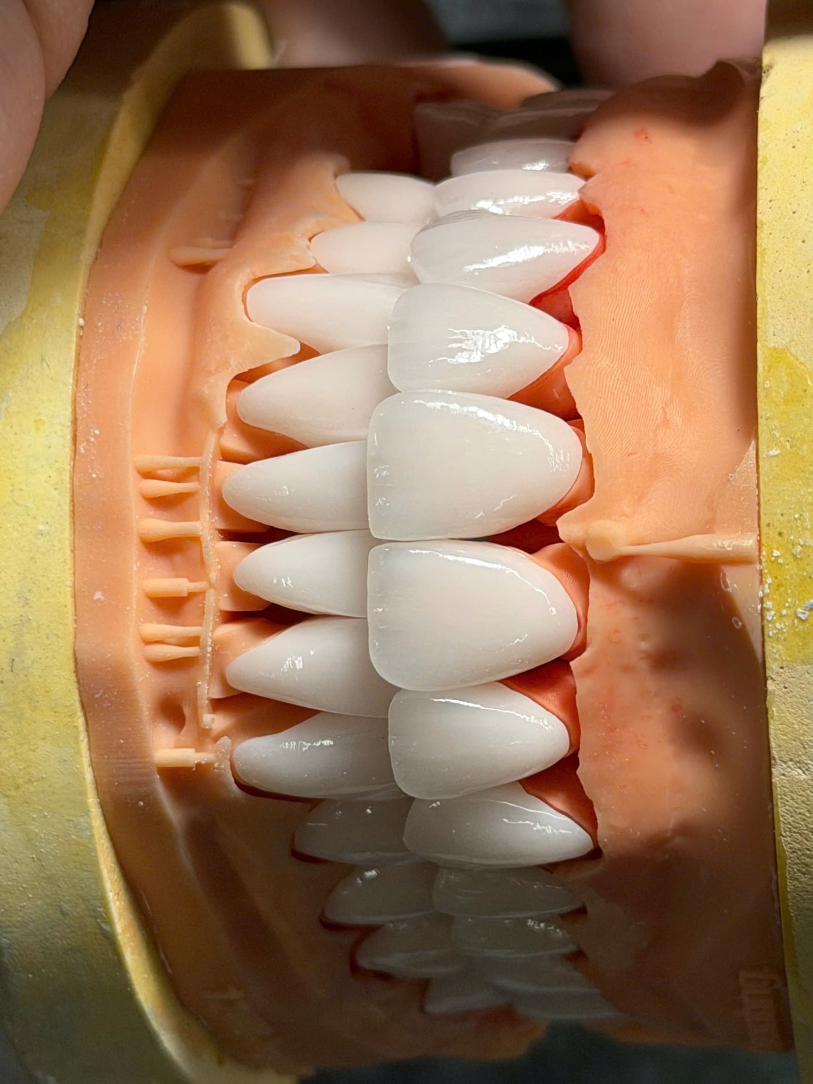 Hình ảnh sản phẩm Pro Dental Lab