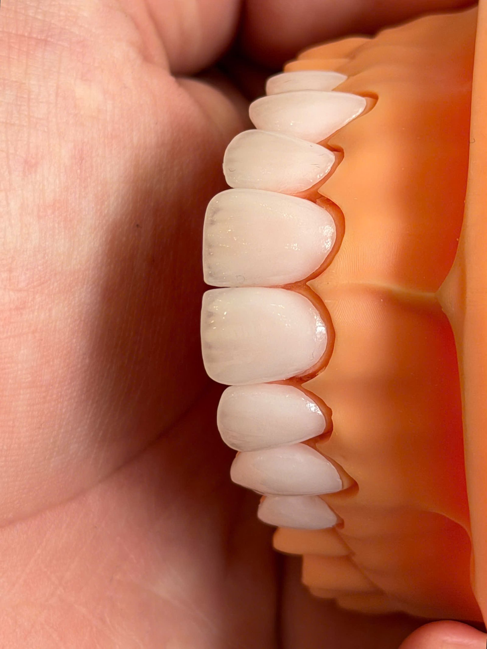 Hình ảnh sản phẩm Pro Dental Lab