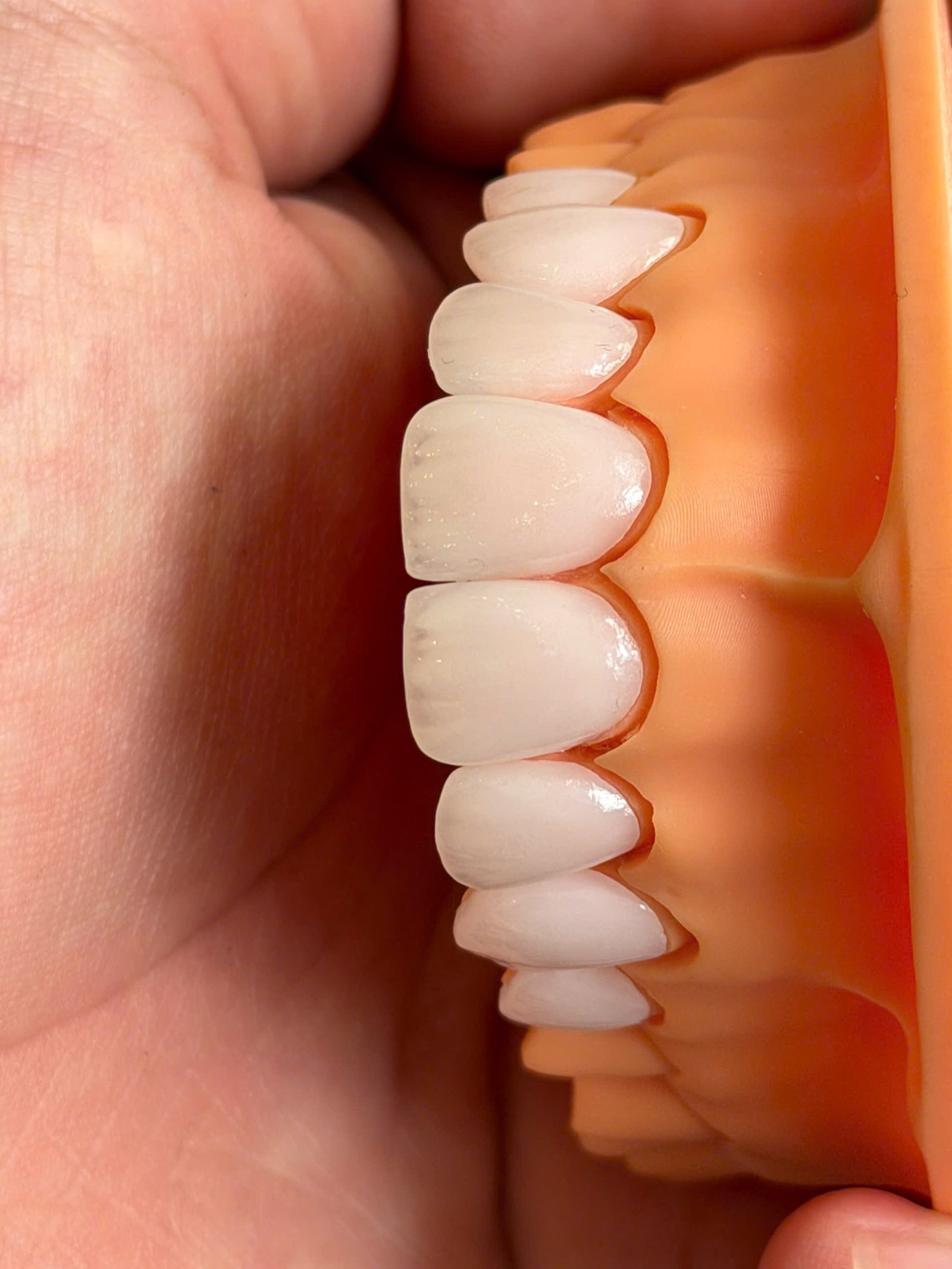 Hình ảnh sản phẩm Pro Dental Lab