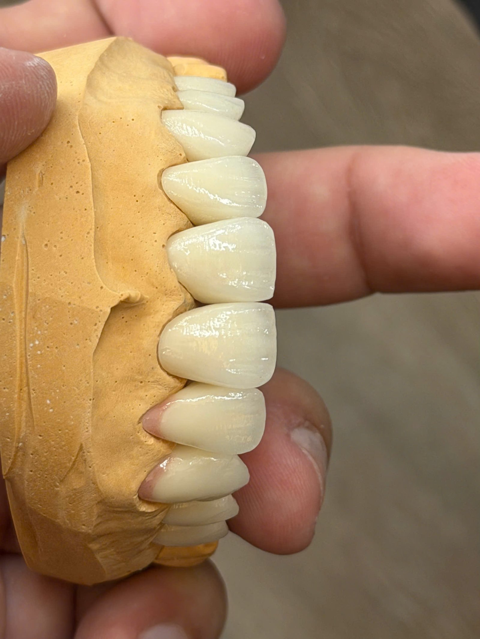 Hình ảnh sản phẩm Pro Dental Lab