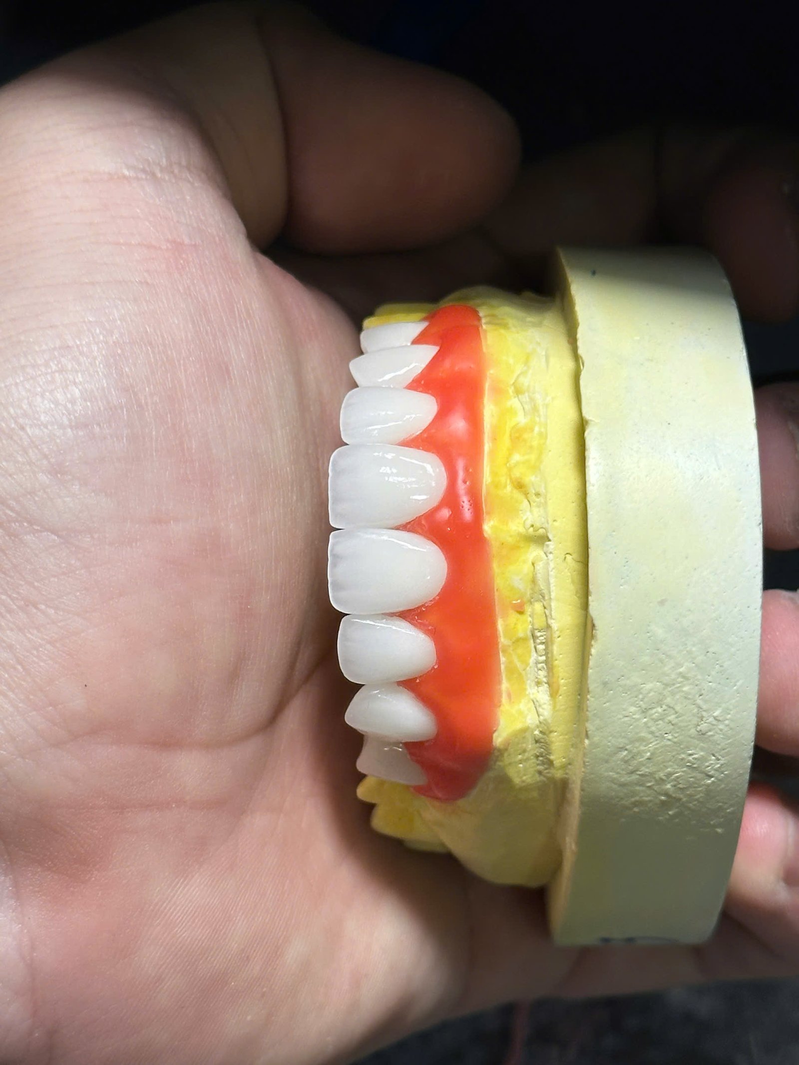 Hình ảnh sản phẩm Pro Dental Lab