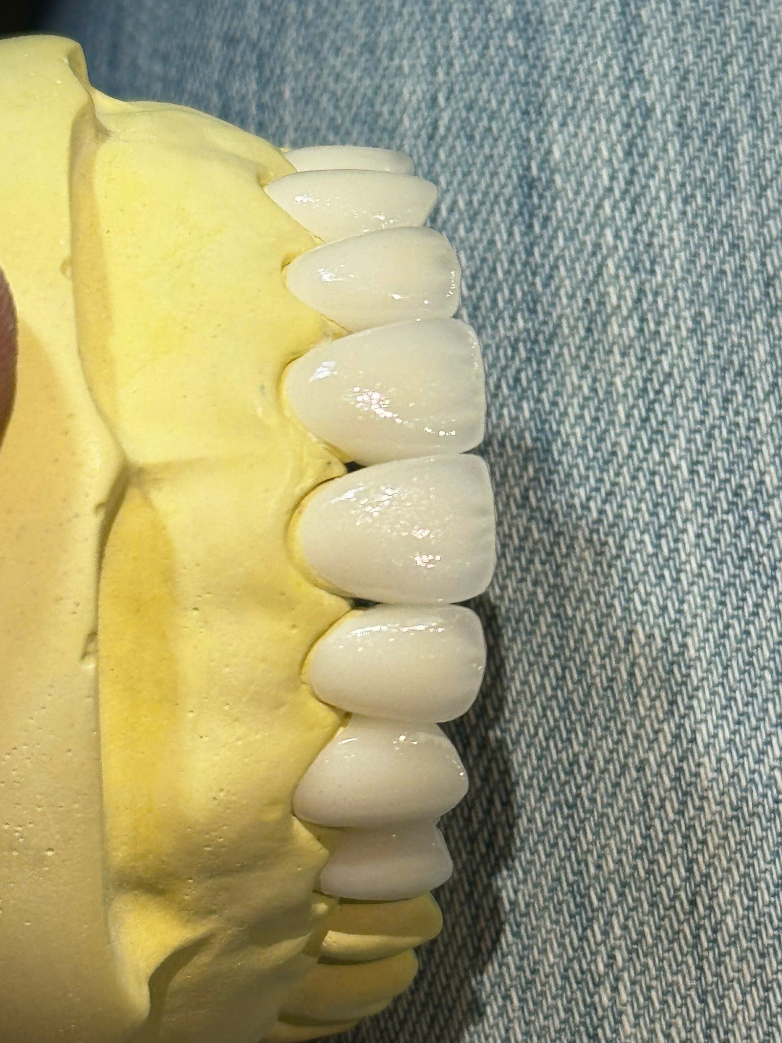 Hình ảnh sản phẩm Pro Dental Lab