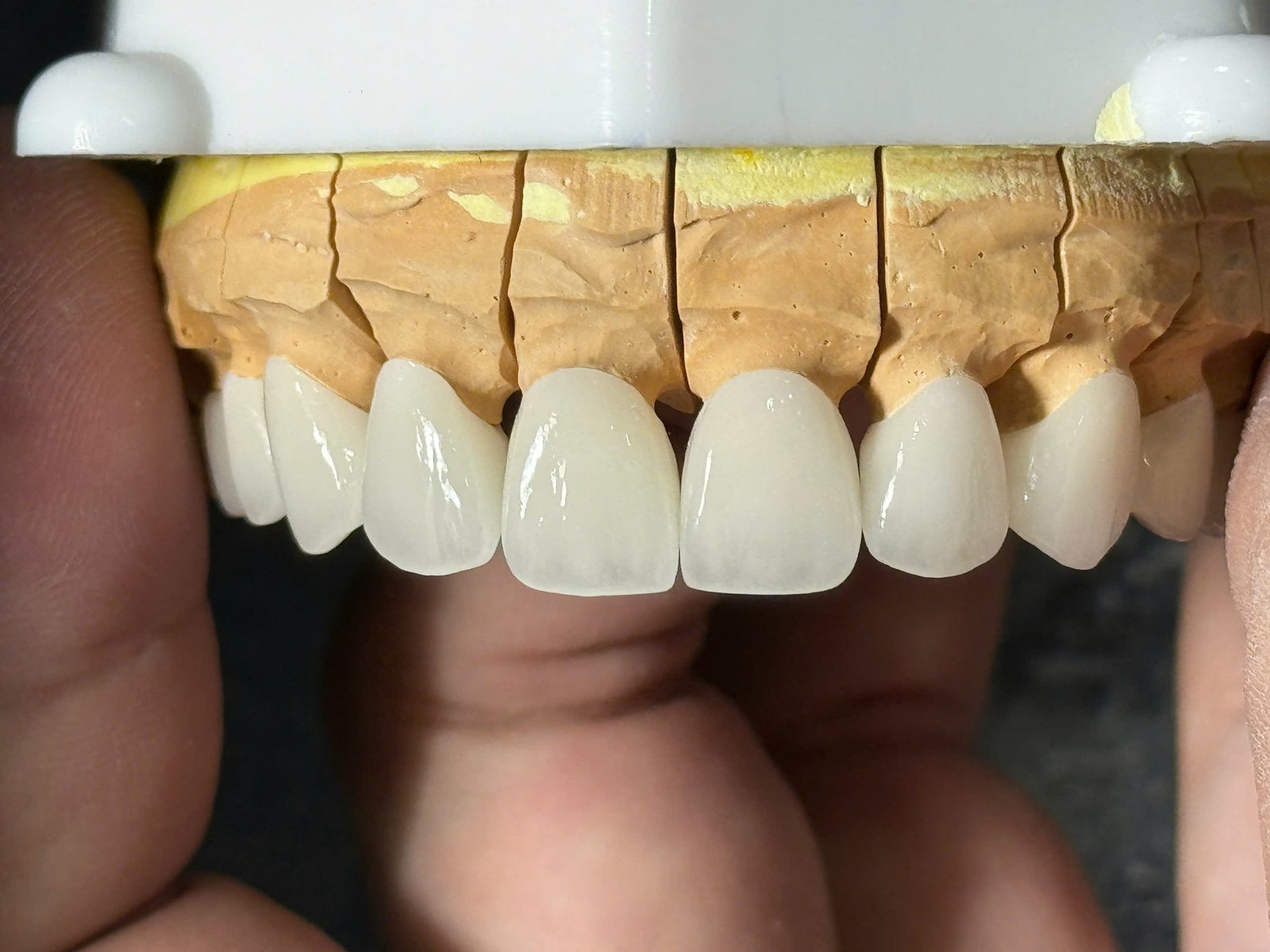 Hình ảnh sản phẩm Pro Dental Lab