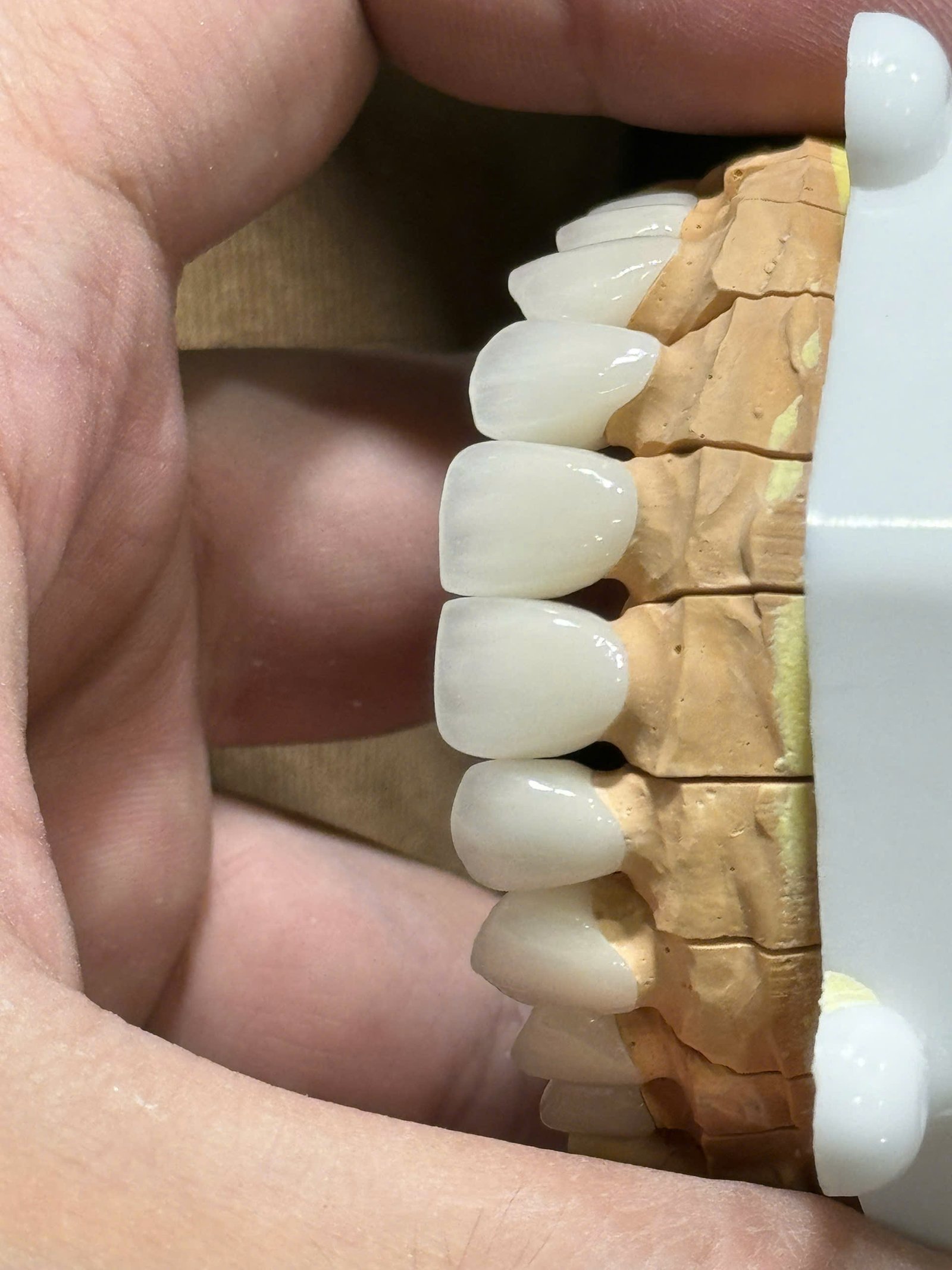 Hình ảnh sản phẩm Pro Dental Lab