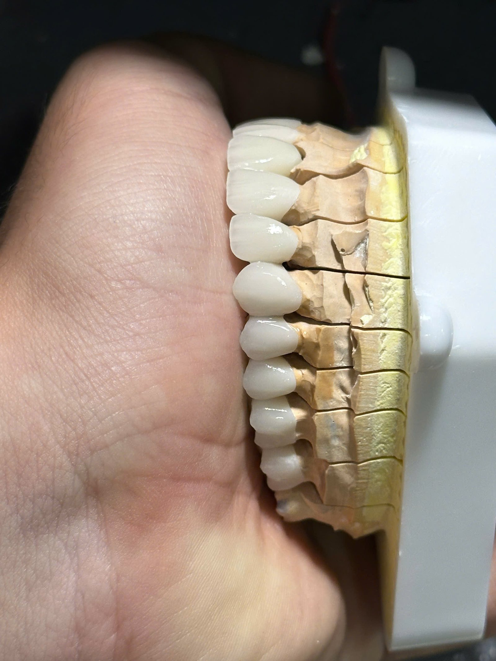 Hình ảnh sản phẩm Pro Dental Lab