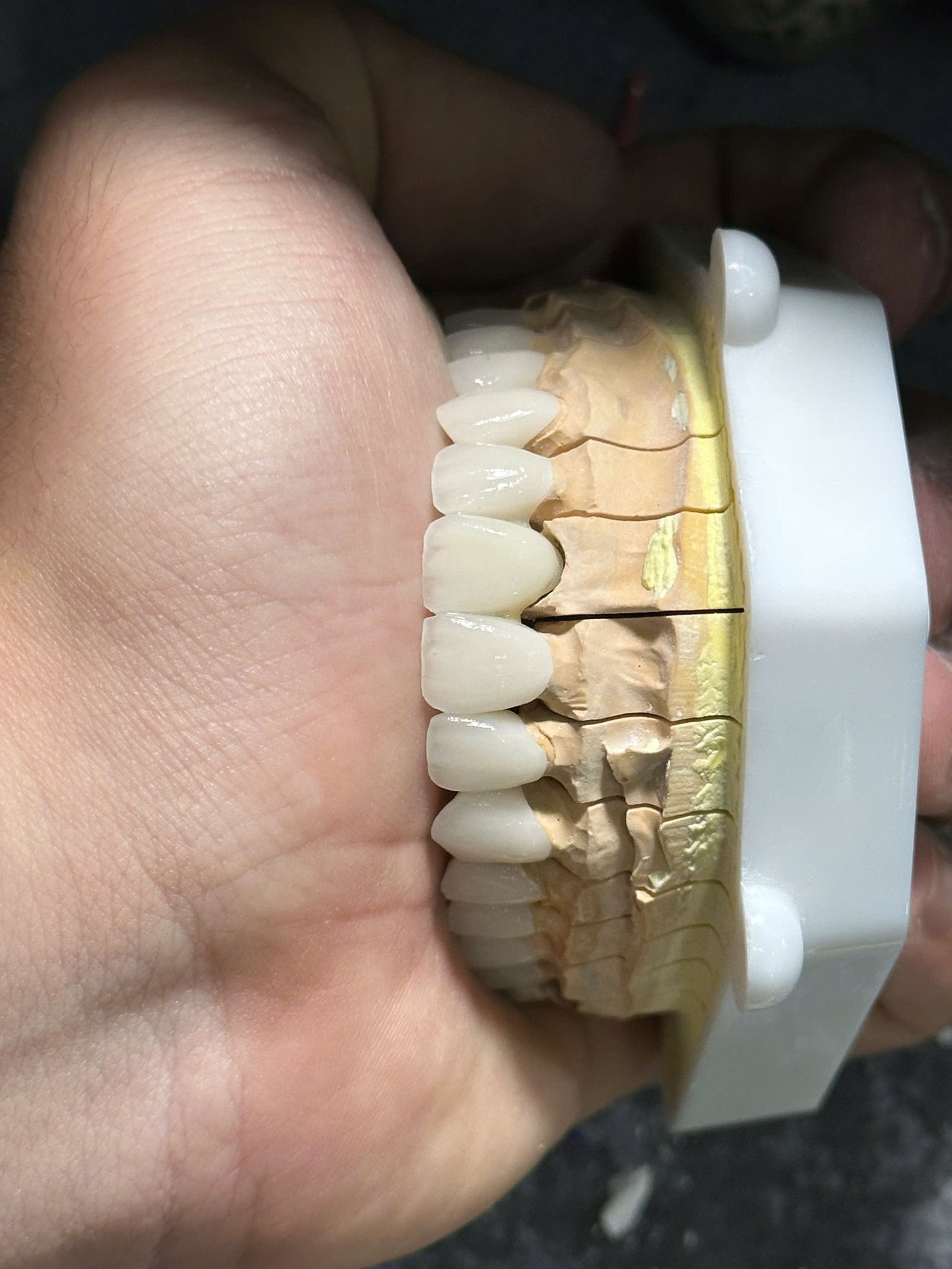 Hình ảnh sản phẩm Pro Dental Lab