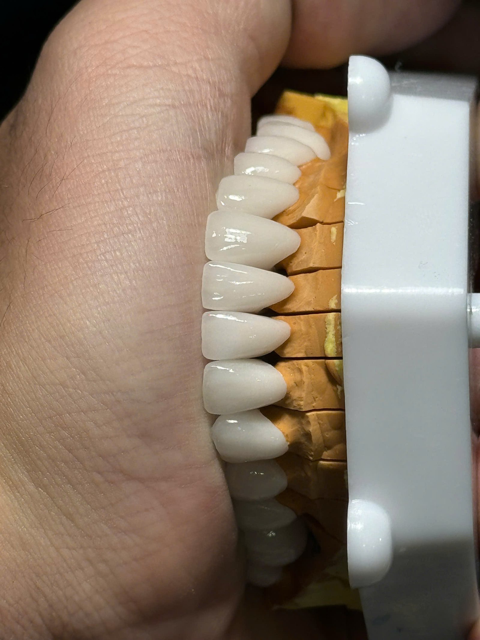 Hình ảnh sản phẩm Pro Dental Lab