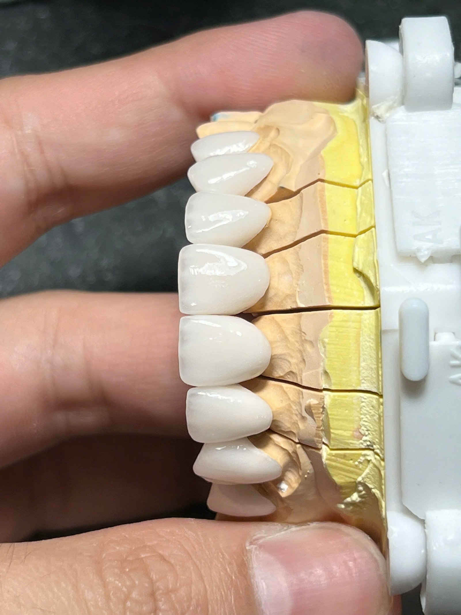 Hình ảnh sản phẩm Pro Dental Lab
