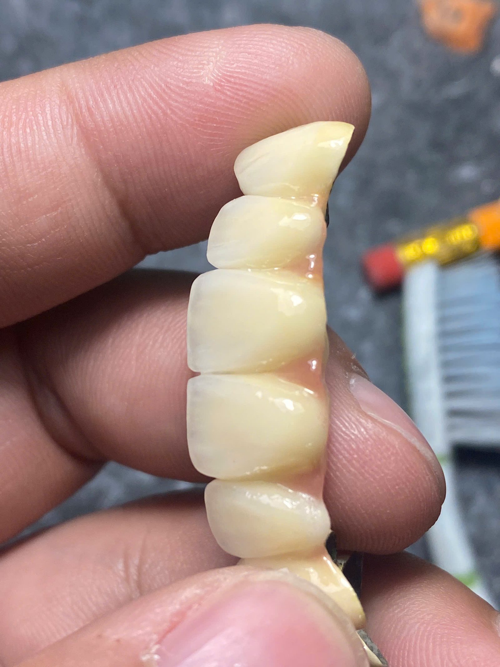 Hình ảnh sản phẩm Pro Dental Lab