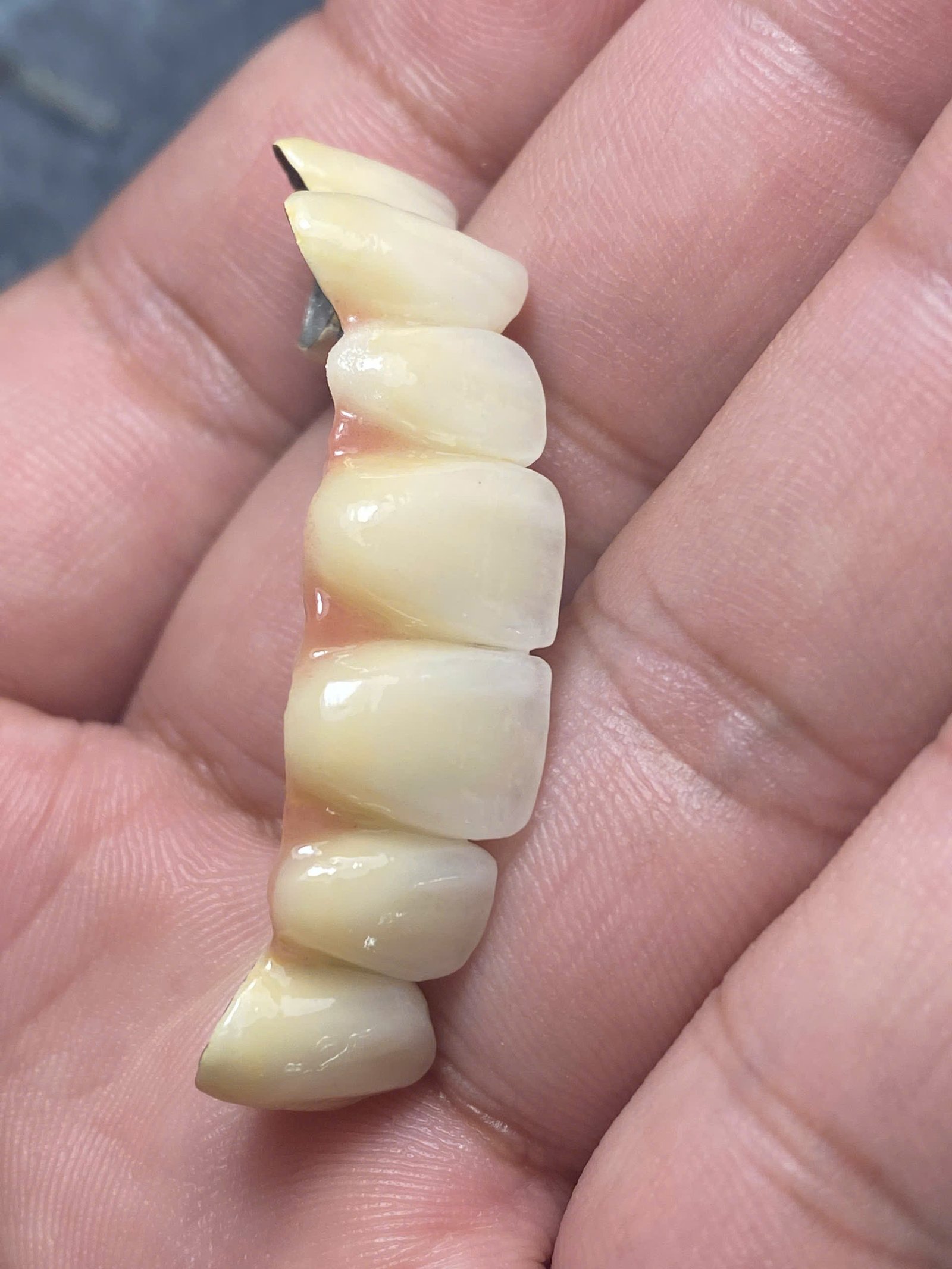 Hình ảnh sản phẩm Pro Dental Lab