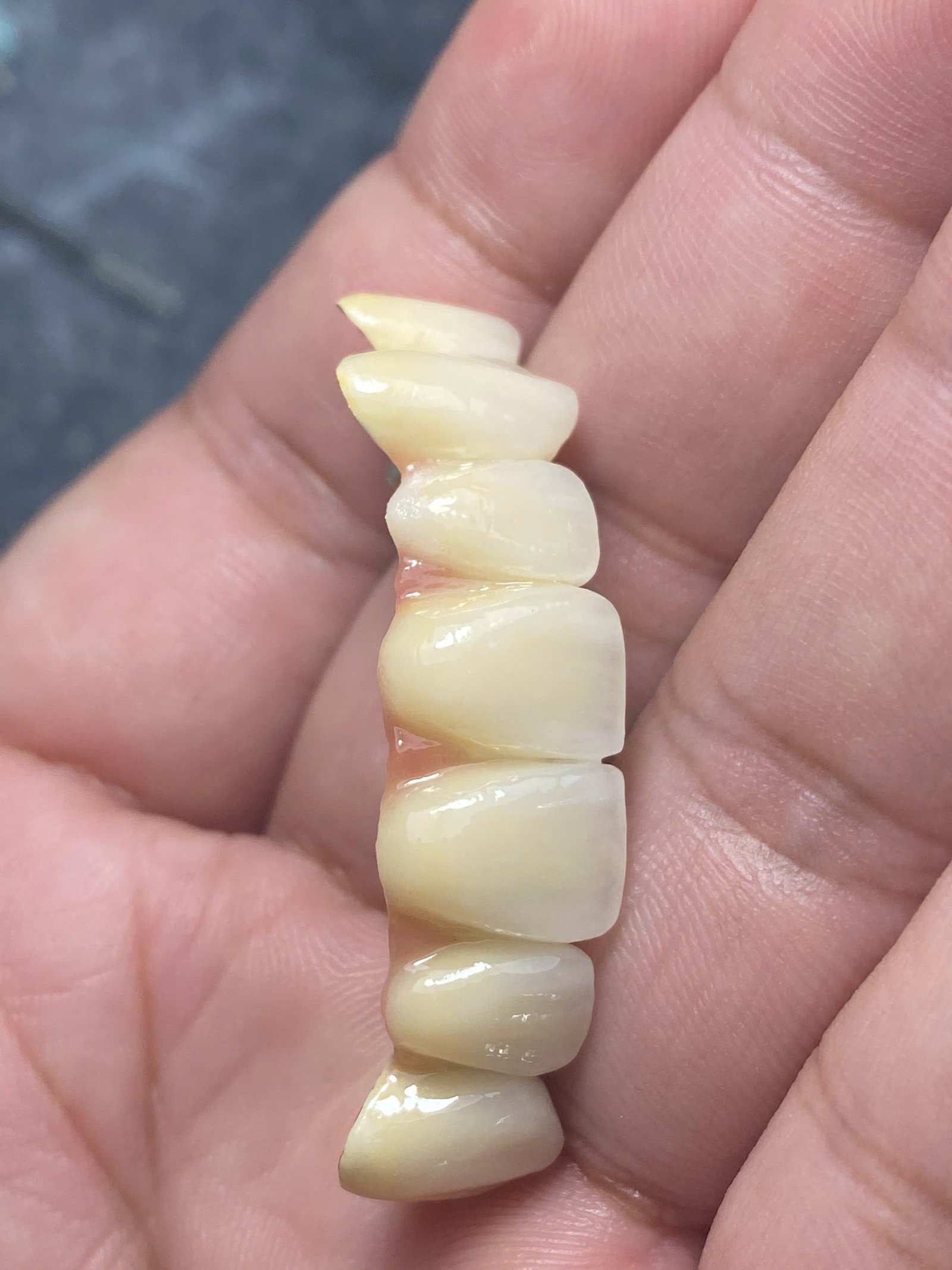 Hình ảnh sản phẩm Pro Dental Lab
