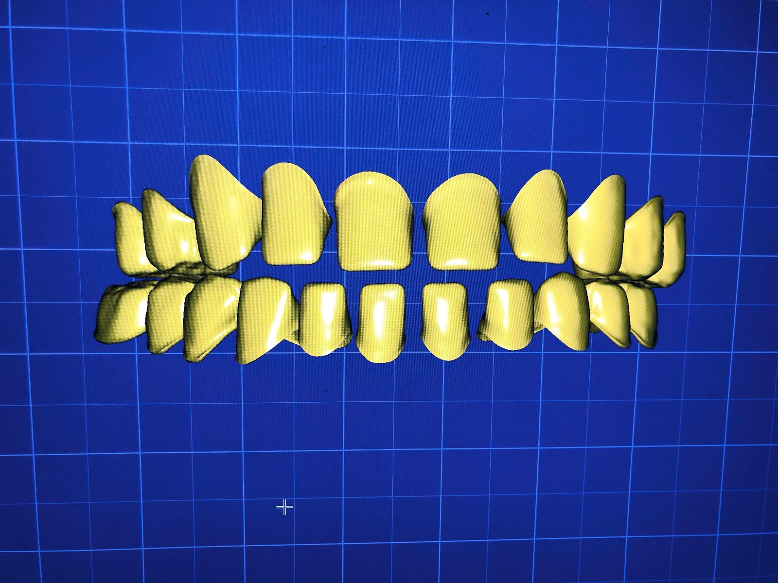 Hình ảnh sản phẩm Pro Dental Lab