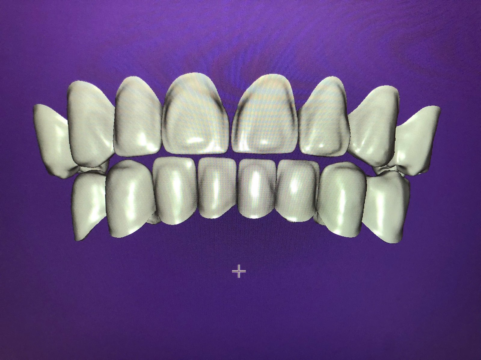Hình ảnh sản phẩm Pro Dental Lab